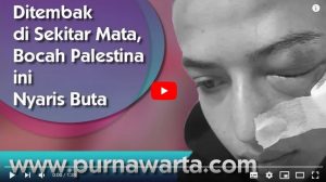 Ditembak di Sekitar Mata, Bocah Palestina ini Nyaris Buta