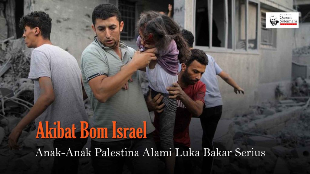 [VIDEO] - Anak-Anak Palestina Alami Luka Bakar Serius Akibat Bom Israel