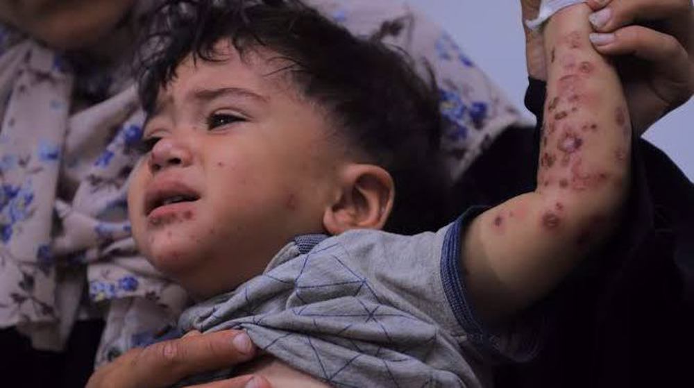 UNRWA